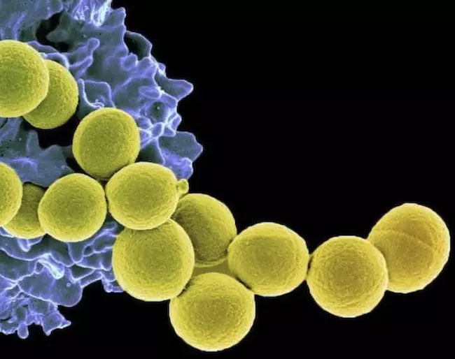 枯草菌がフェーズ2試験で黄色ブドウ球菌のコロニー形成を顕著に抑制。