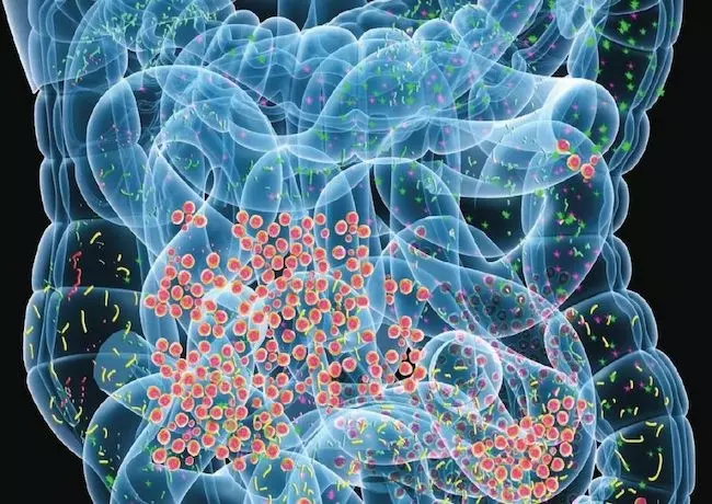 前癌性大腸ポリープと腸内細菌の接点を解明した最新研究